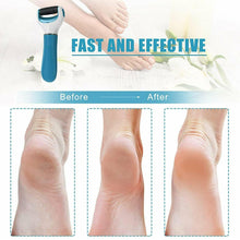 0229 Electronic Dry Foot File Callous Remover For Feet Electric Foot With Roller Hard And Dead Skin- Regular Coarse Baby Smooth Feet In Minutes. For In Home Padicure Foot Care Battery Powered  Usb (Battry Not Included)