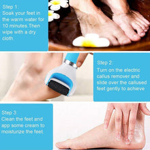 0229 Electronic Dry Foot File Callous Remover For Feet Electric Foot With Roller Hard And Dead Skin- Regular Coarse Baby Smooth Feet In Minutes. For In Home Padicure Foot Care Battery Powered  Usb (Battry Not Included)